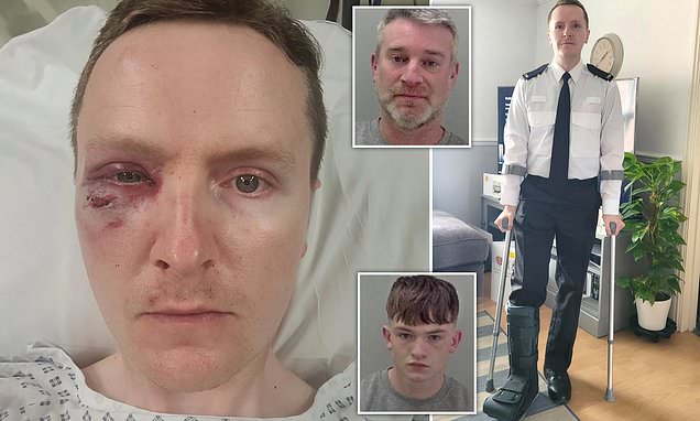 Police Federation Warns of "Caretaker" Role as Attacker Serves Just Three Months for Near-Fatal Assault on Officer